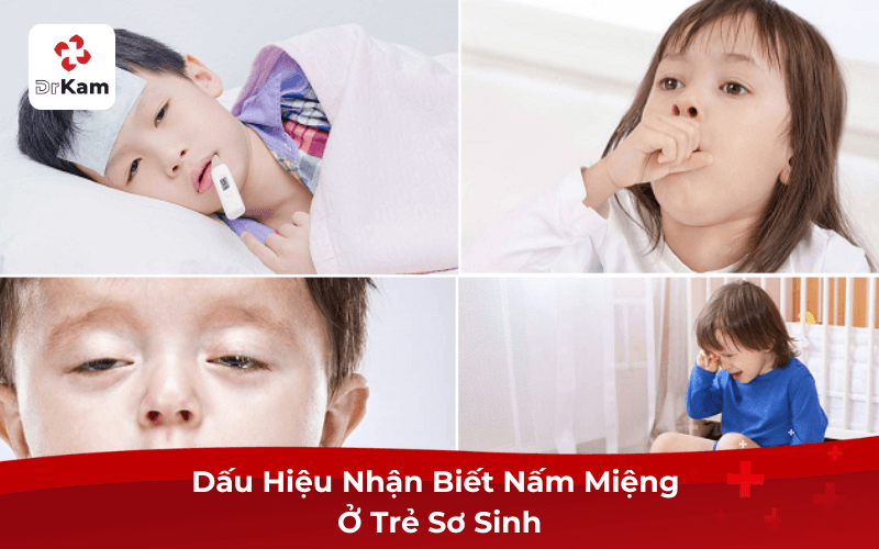 Dấu Hiệu Nhận Biết Nấm Miệng Ở Trẻ Sơ Sinh