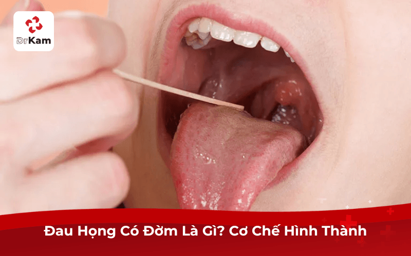Đau Họng Có Đờm Là Gì? Cơ Chế Hình Thành