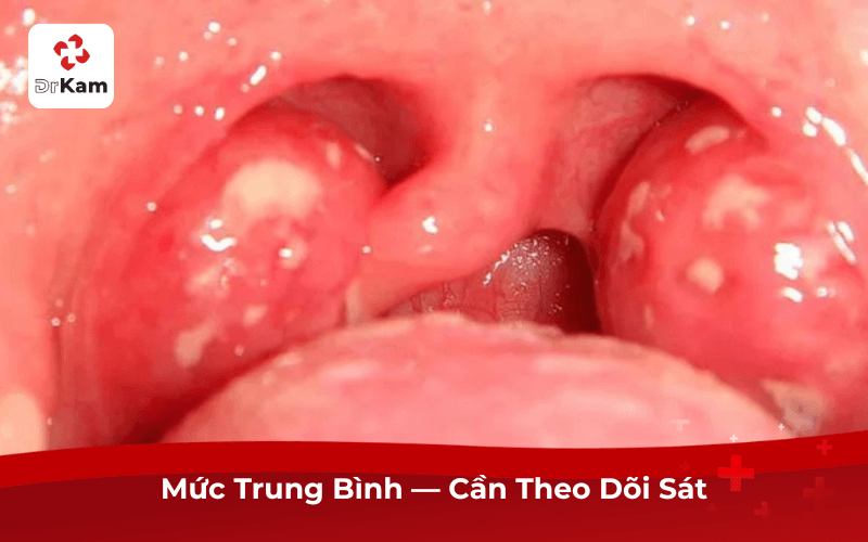 Mức Trung Bình — Cần Theo Dõi Sát