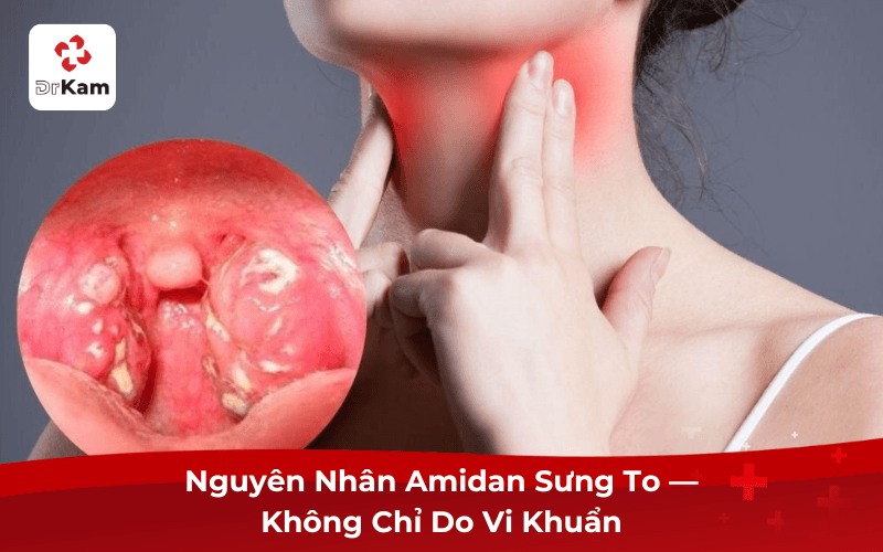 Nguyên Nhân Amidan Sưng To — Không Chỉ Do Vi Khuẩn