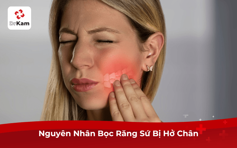 Nguyên Nhân Bọc Răng Sứ Bị Hở Chân