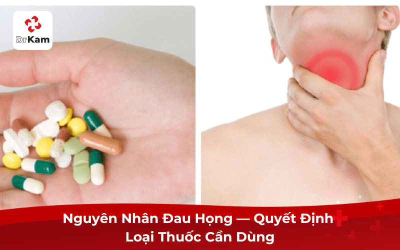 Nguyên Nhân Đau Họng — Quyết Định Loại Thuốc Cần Dùng