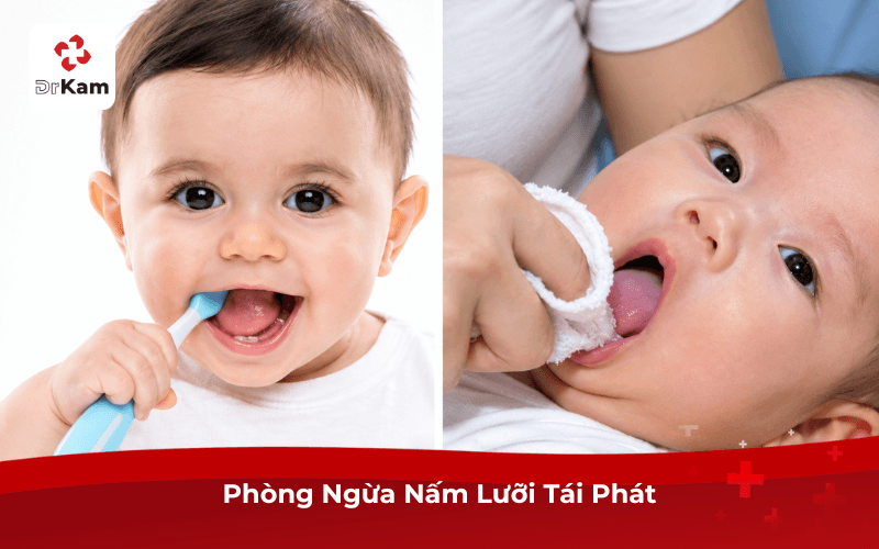 Phòng Ngừa Nấm Lưỡi Tái Phát